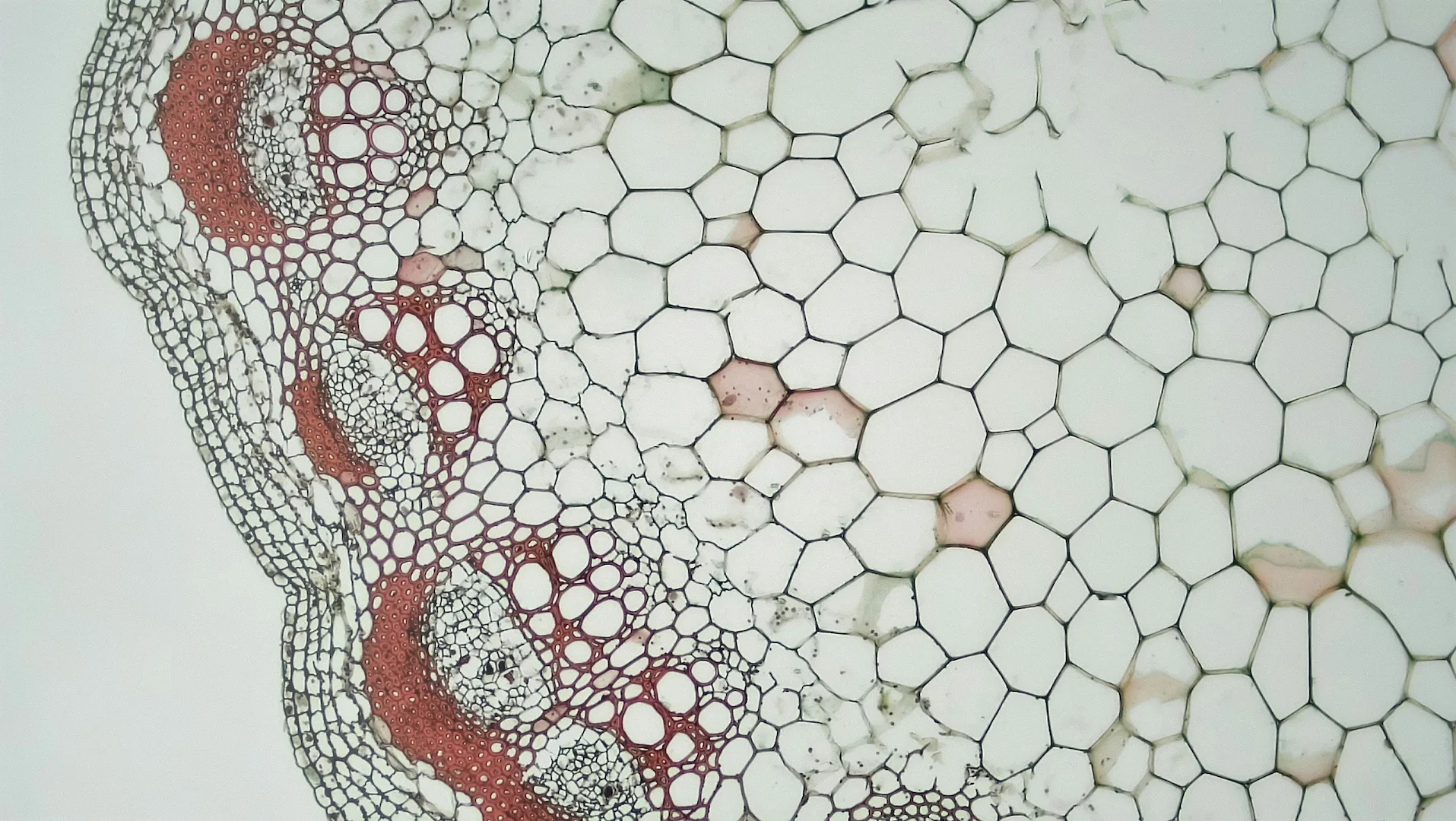 Racial bias in AI-mediated psychiatric diagnosis and treatment: a qualitative comparison of four large language models