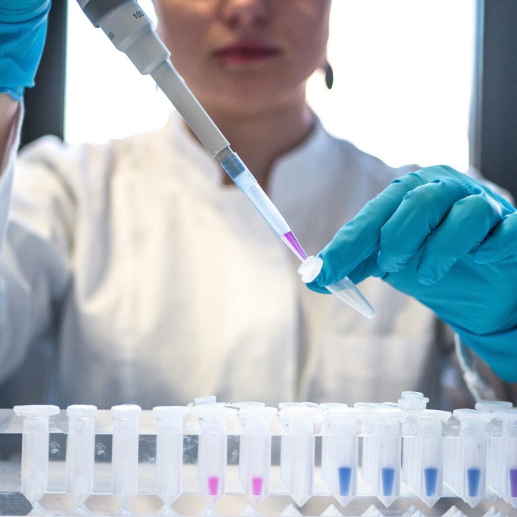 Helicobacter Pylori Associated Depression among Patients Presenting with Epigastric Pain